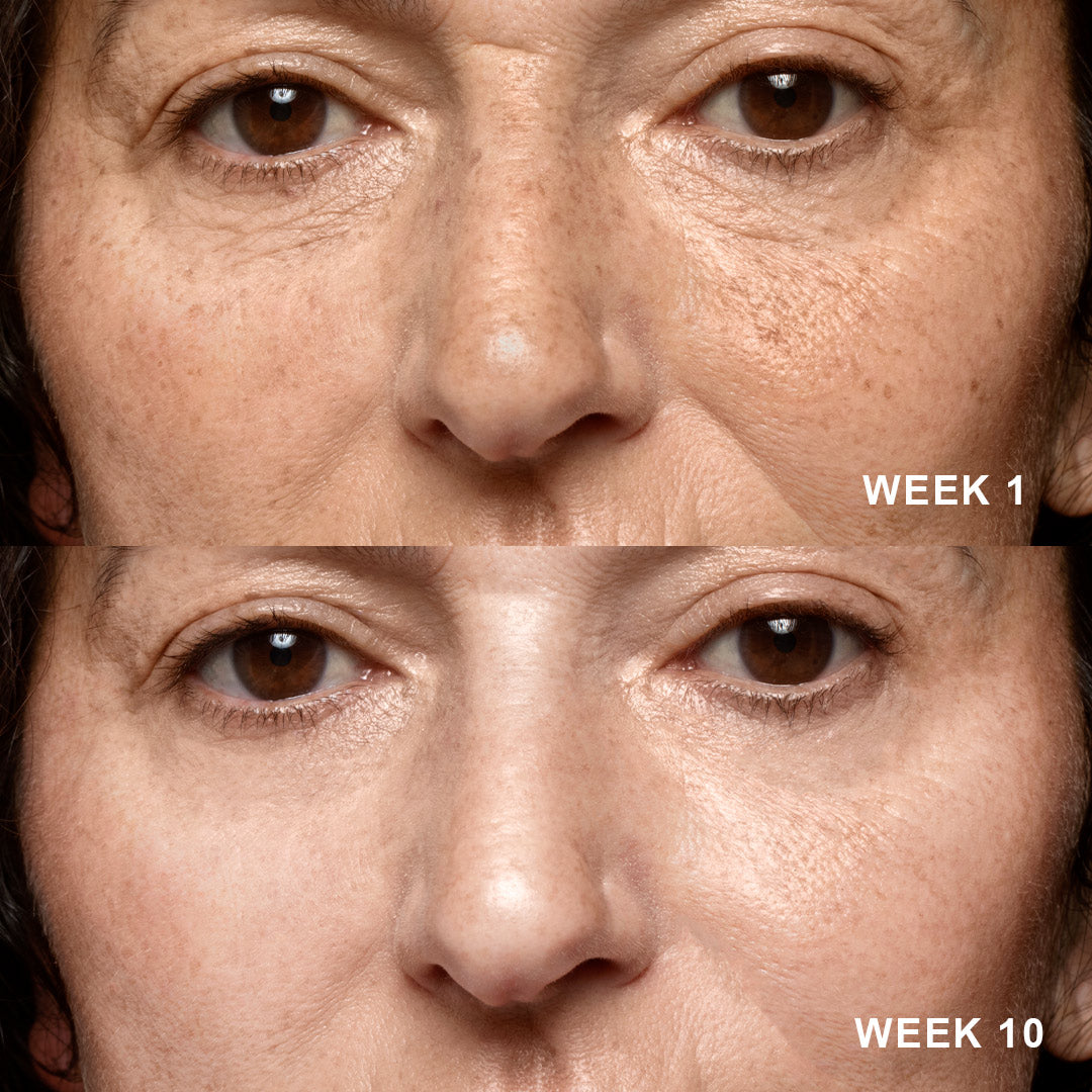 NEW 5-in-1 Powerful Skin Care Serum