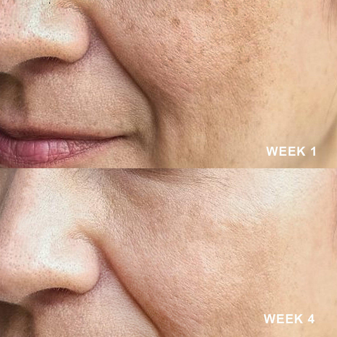 NEW 5-in-1 Powerful Skin Care Serum